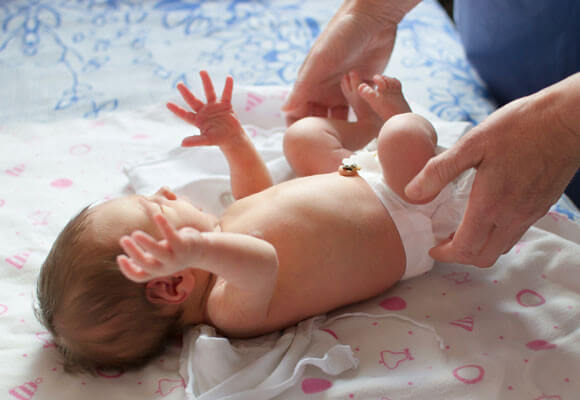 perawatan tali pusat bayi